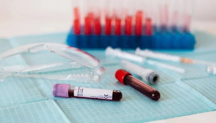 New blood type discovered in French...