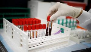 French scientists find new blood type...